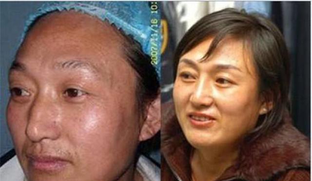 举重队禁药_举重禁药都是什么药_举重冠军禁药
